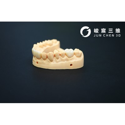 上海峻宸3D打印产品定制，3D打印牙齿陶瓷内冠